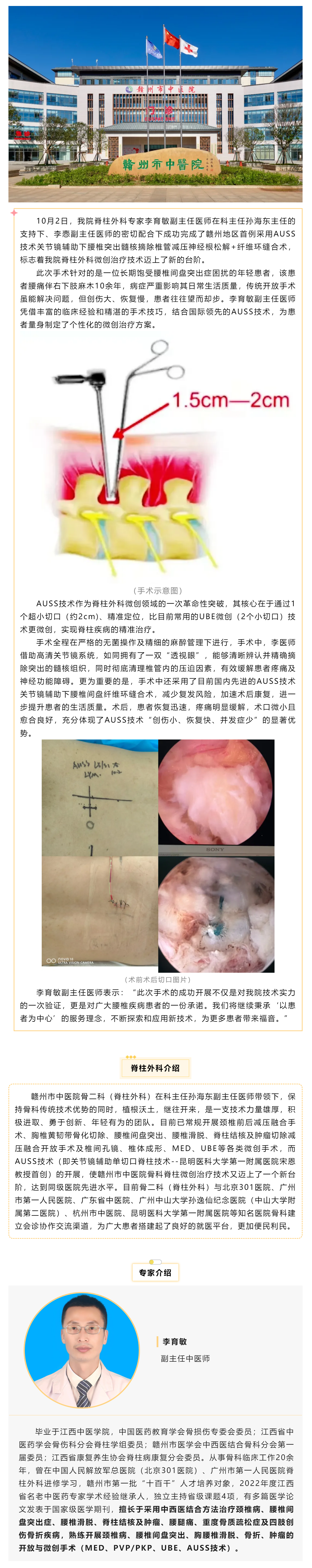 全市首例！我院成功實(shí)施AUSS技術(shù)關(guān)節(jié)鏡輔助下腰椎突出髓核摘除椎管減壓神經(jīng)根松解+纖維環(huán)縫合術(shù).png